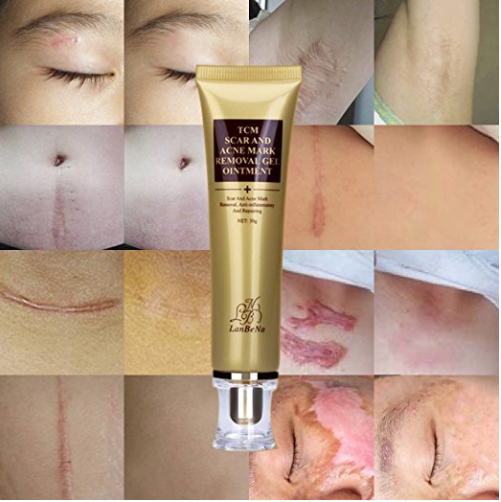 Scar and Acne Remover Gel Cream