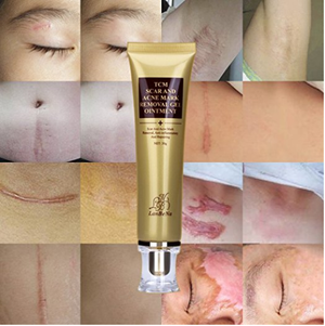 Scar and Acne Remover Gel Cream